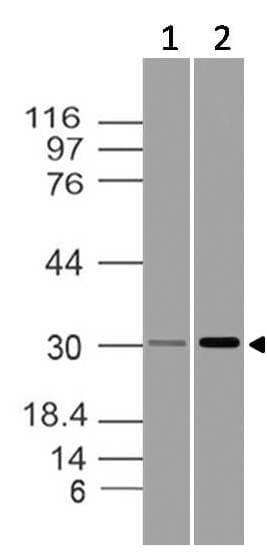 IL-1B / IL-1 Beta Antibody