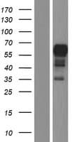 SDCCAG3 Protein (Over-Expression Lysate Myc-DDK (Flag))