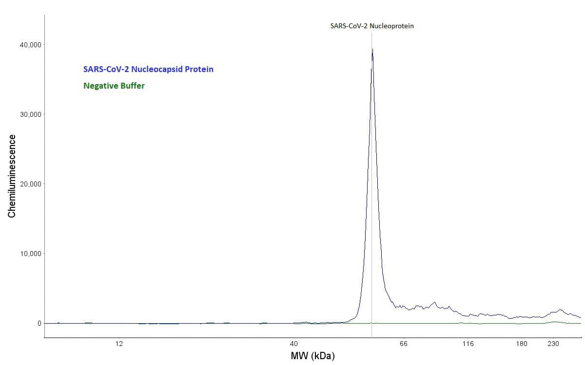 SARS-CoV-2 Nucleoprotein Antibody
