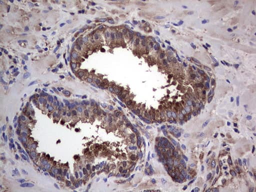 GARS / Glycyl tRNA Synthetase Antibody (clone OTI4G4)