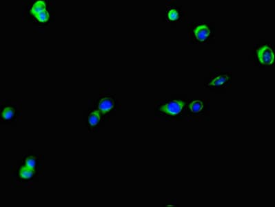 Polyclonal Rabbit anti-Human KIAA0513 Antibody