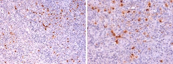 CLC Antibody