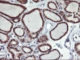 ALG2 Antibody (clone OTI3C2, Carrier-free)