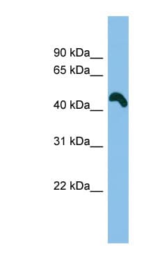 TRIM54 / MURF Antibody (aa107-156)