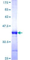 Human MARCH6 / DOA10 Protein (Recombinant GST, N-terminus)