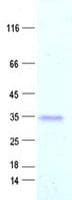 Human DKK1 Protein (Recombinant DDK,C-terminus)