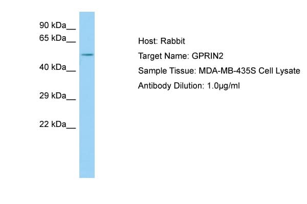 Polyclonal Rabbit anti-Human GPRIN2 / GRIN2 Antibody (aa21-70, WB)
