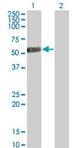 IL13RA2 / IL13R Alpha 2 Antibody (clone 2E10)