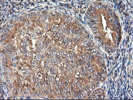 TUBAL3 Antibody (clone OTI4D8)