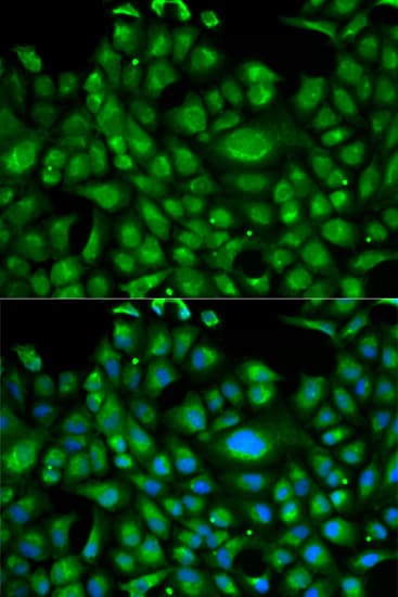 Polyclonal Rabbit anti-Human HSPA1L Antibody (IHC, IF, WB)