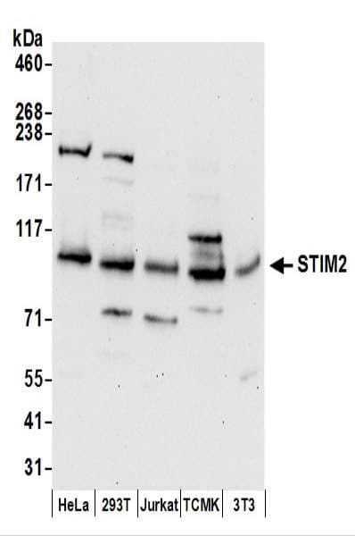 STIM2 Antibody (aa650-700)