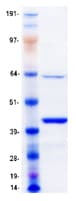 Human MBNL1 / MBNL Protein (Recombinant Myc-DDK (Flag))