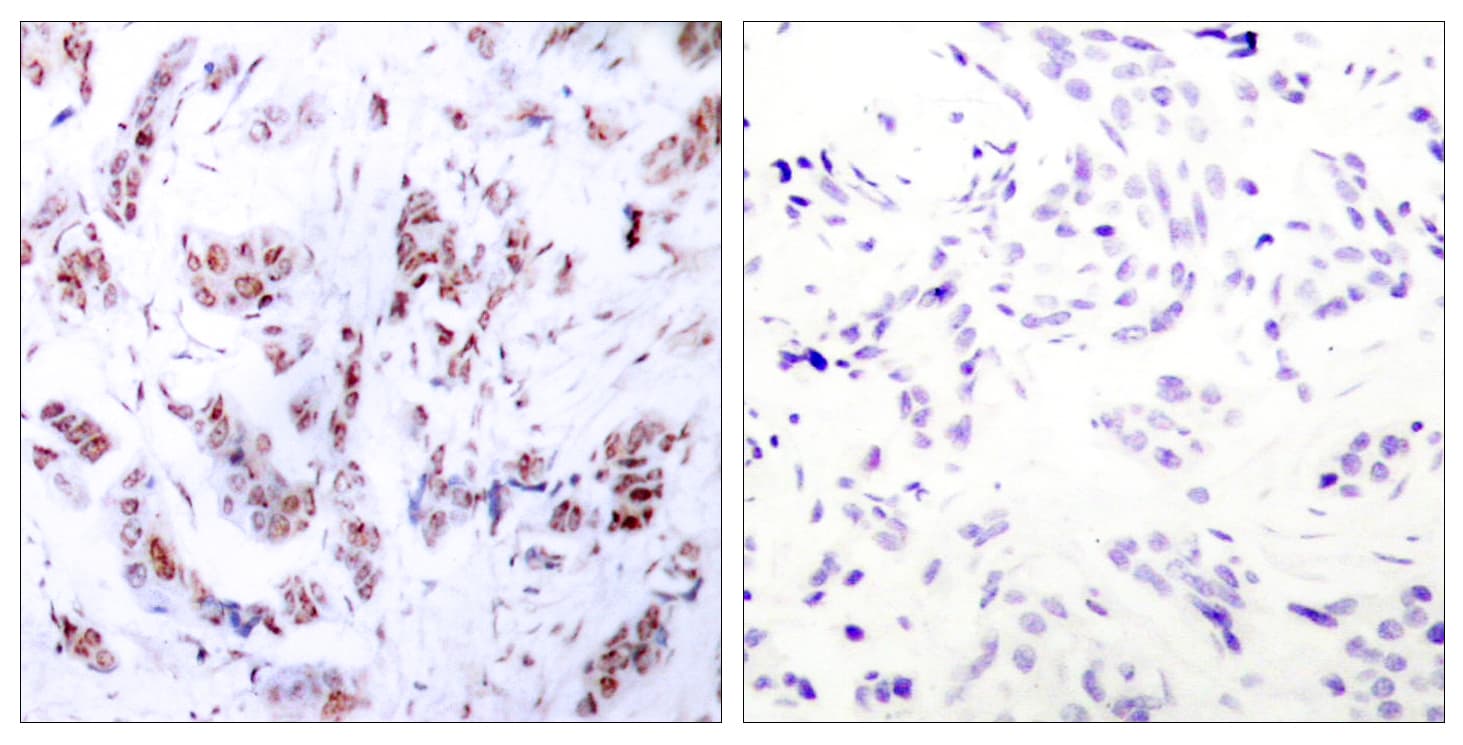 Polyclonal Rabbit anti-Human MEF2A / MEF2 Antibody (aa279-328, IHC, WB)