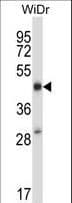 Polyclonal Rabbit anti-Human STEAP1 / STEAP Antibody (aa2-31, IHC, WB)