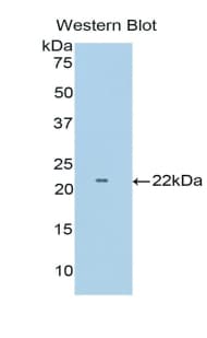 TNFRSF1B / TNFR2 Antibody (aa303-474)