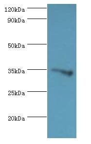 GLYATL1 Antibody (aa1-302)