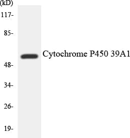 Polyclonal Rabbit anti-Human CYP2D6 Antibody (aa228-277, WB)
