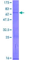Human ERI2 / EXOD1 Protein (Recombinant GST)