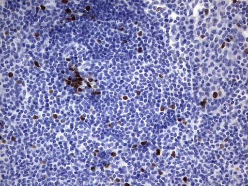 Monoclonal Rat anti-Human MKI67 / Ki67 Antibody (clone OTI3A11, aa1160-1493, IHC)