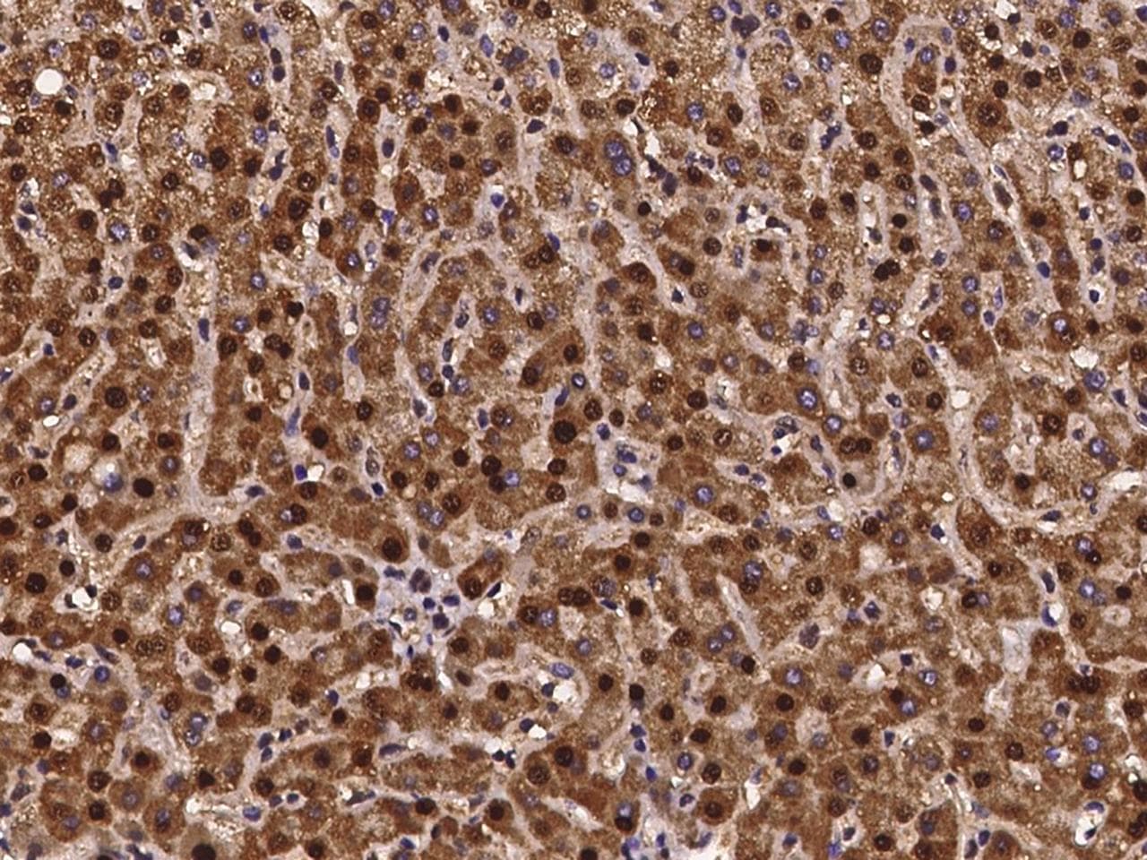 SCLY Antibody