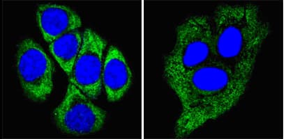 IHC-plus™ KRT8 / CK8 / Cytokeratin 8 Antibody (clone 8A5D12)