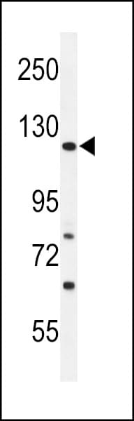 Polyclonal Rabbit anti-Human ARHGAP30 Antibody (aa784-812, IHC, WB)