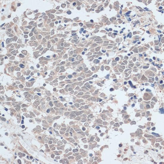 ZNF581 Antibody