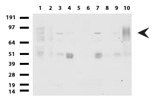 FOXP1 Antibody (clone UMAB89)