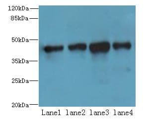 QTRT1 Antibody