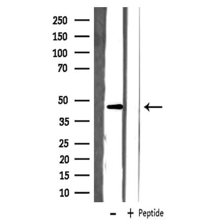 SLC22A18 Antibody