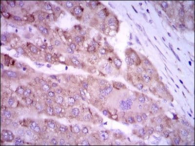 NOS2 / iNOS Antibody (clone 400000)