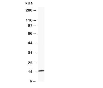 FABP3 / H-FABP Antibody (aa119-133)