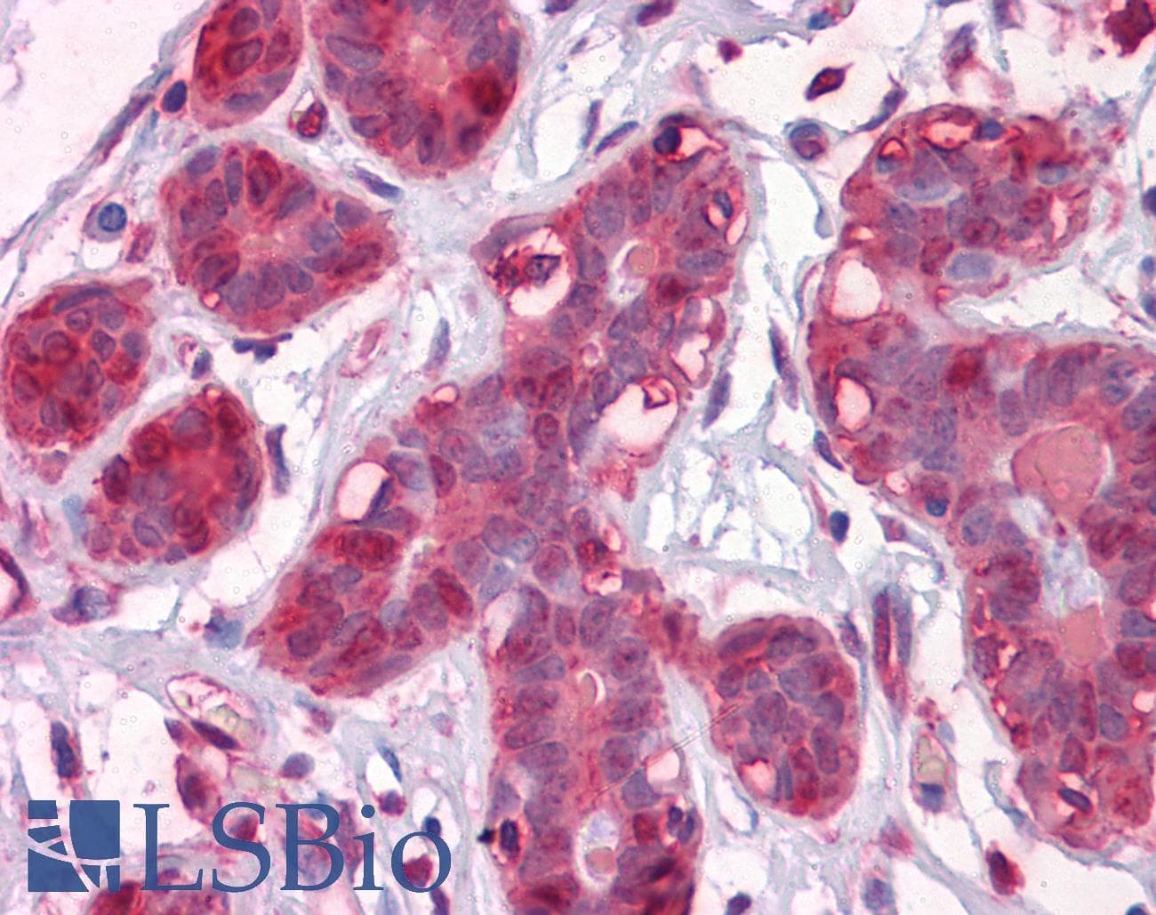 PathPlus™ ENO1 / Alpha Enolase Antibody (clone 8G8)