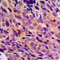 Polyclonal Rabbit anti-Human NFKB1 / NF-Kappa-B Antibody (Internal, IHC, IF, WB)