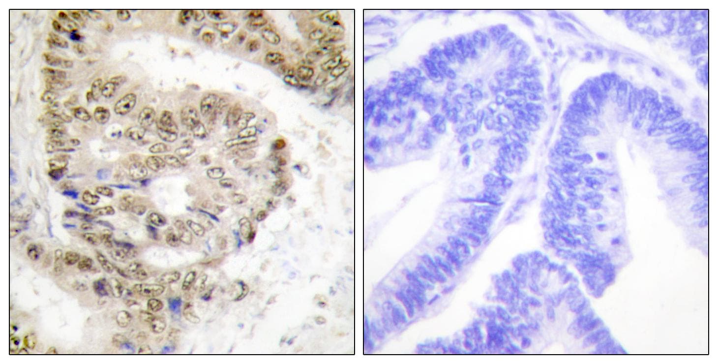 Polyclonal Rabbit anti-Human HNRNPL / hnRNP L Antibody (IHC, IF, WB)