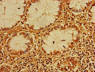 Ceramide Kinase / CERK Antibody