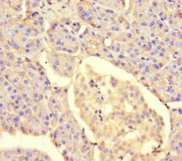 METTL7A Antibody
