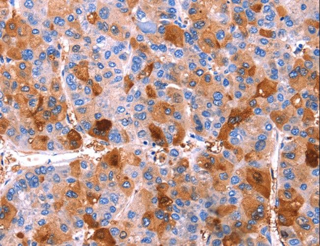 ERN2 Antibody