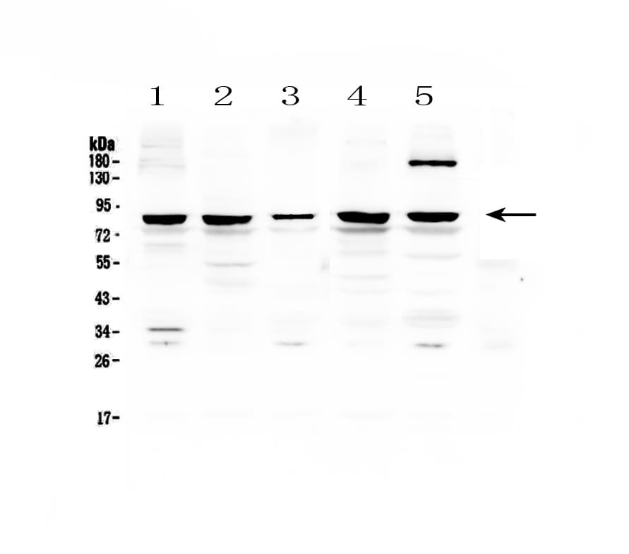 Polyclonal Rabbit anti-Human CARS1 / CARS Antibody (WB)