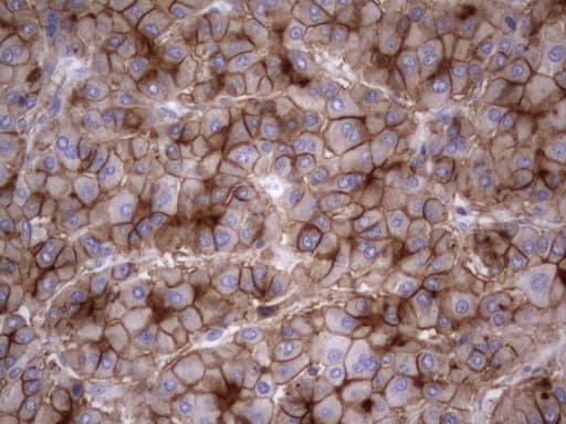 CEACAM5 / CD66e Antibody (aa35-680, clone OTI1D4)