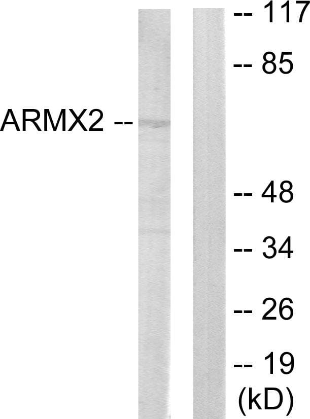 Polyclonal Rabbit anti-Human ARMCX2 Antibody (IF, WB)