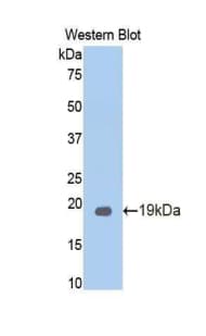 CEA / Carcinoembryonic Antigen Antibody (aa85-222)