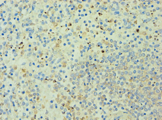Polyclonal Rabbit anti-Human AMPD3 Antibody (aa1-260, IHC)