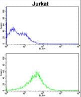 RCBTB2 Antibody (aa71-99)