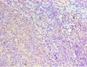 Polyclonal Rabbit anti-Human HOXA1 Antibody (aa75-205, IHC)