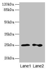 IHC-plus™ Polyclonal Rabbit anti-Human RAB11B Antibody (IHC, WB)