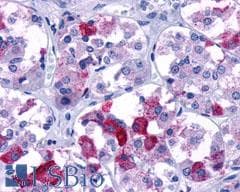 PathPlus™ AVPR1B Antibody (N-Terminus)