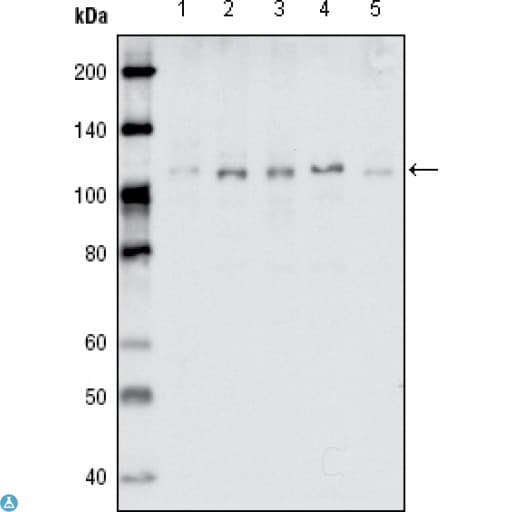 EPHB1 / EPH Receptor B1 Antibody