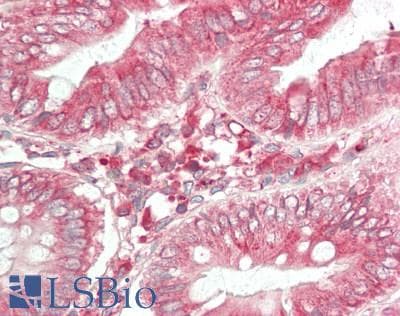 Polyclonal Rabbit anti-Human JAG2 / Jagged-2 Antibody (aa714-981, IHC, WB)