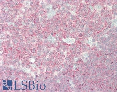 IHC-plus™ c-Src Kinase / CSK Antibody (aa400-450)
